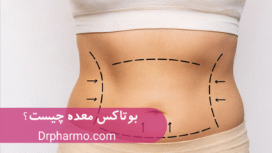 آیا بوتاکس معده می‌تواند جایگزینی برای جراحی‌های کاهش وزن باشد؟