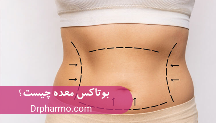 آیا بوتاکس معده می‌تواند جایگزینی برای جراحی‌های کاهش وزن باشد؟