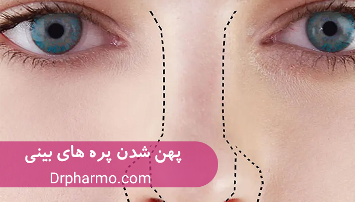 علت پهن شدن پره های بینی بعد از عمل