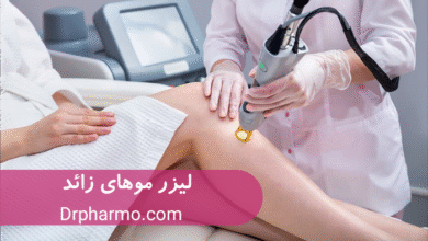 لیزر موهای کرکی و نازک بهترین روش از بین بردن مو